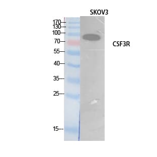CSF3R / CD114 Antibody