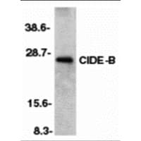 CIDEB Antibody