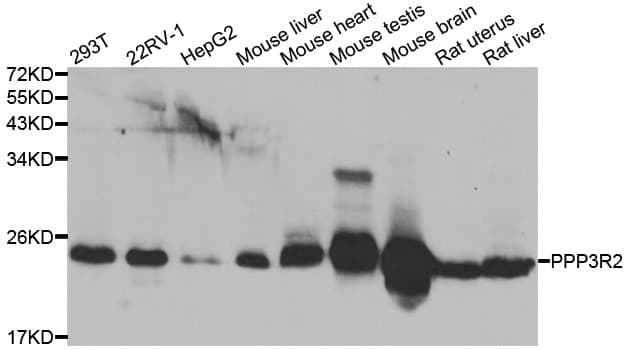 PPP3R2 Antibody
