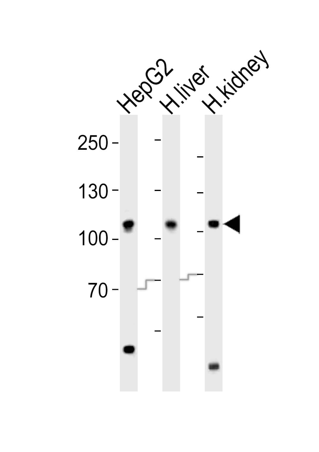 IHC-plus™ MTTP / MTP Antibody (aa878-911)