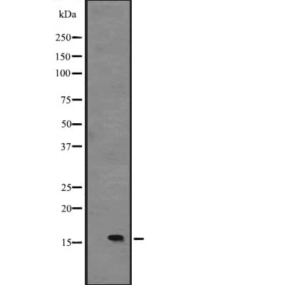 Polyclonal Rabbit anti-Human IL15 Antibody (IHC, WB)