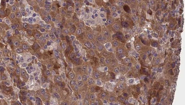 GJB3 / CX31 / Connexin 31 Antibody