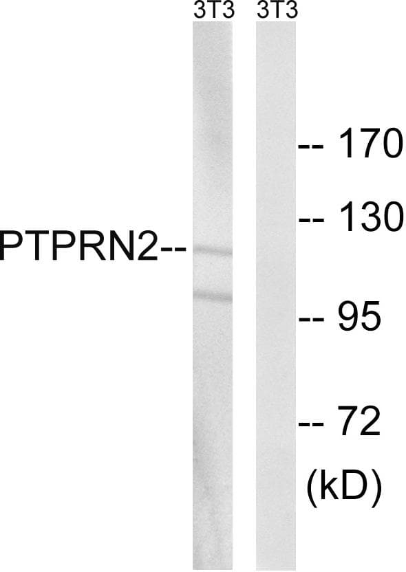 PTPRN2 / Phogrin Antibody