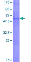 Human OR6C3 Protein (Recombinant GST)