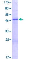 Human TPRG1L Protein (Recombinant GST)