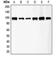 FGFR3 Antibody (Internal)