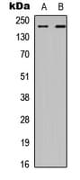 Polyclonal Rabbit anti-Human CHD2 Antibody (Internal, WB)
