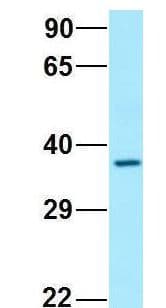 SCN4 / G6PC3 Antibody (aa86-135)
