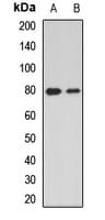 DVL2 / Dishevelled 2 Antibody