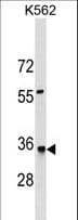 HMGCL Antibody (aa71-99)