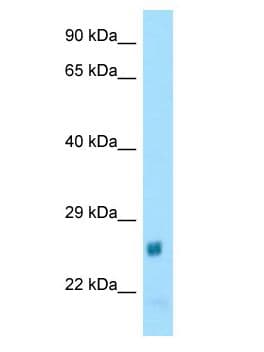 NAT15 Antibody (aa63-112)