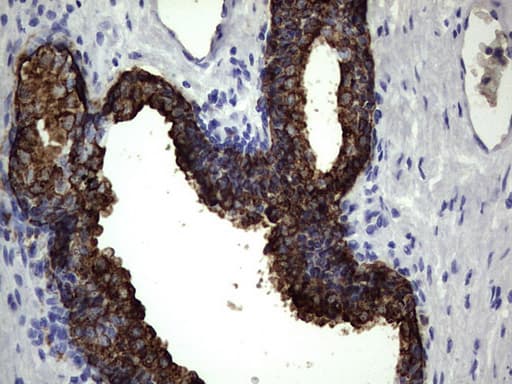 Monoclonal Mouse anti-Human KRT19 / CK19 / Cytokeratin 19 Antibody (clone OTI9A9, aa240-390, IHC)