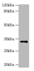 Polyclonal Rabbit anti-Human HSD11B1 / HSD11B Antibody (aa25-292, IHC, WB)