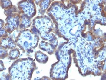 MAML3 / CAGH3 Antibody (clone MAML3/1303)