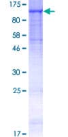 Human MANBA Protein (Recombinant GST)