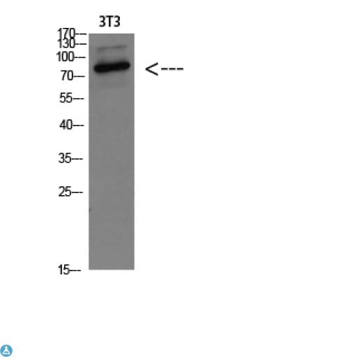 Polyclonal Rabbit anti-Human HSPA5 / GRP78 / BiP Antibody (WB)