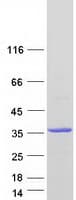 Human THTPA Protein (Recombinant Myc-DDK (Flag))