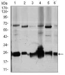 ARHGDIA / RHOGDI Antibody (Amino Acid: FULL 1-204, clone 2G3)