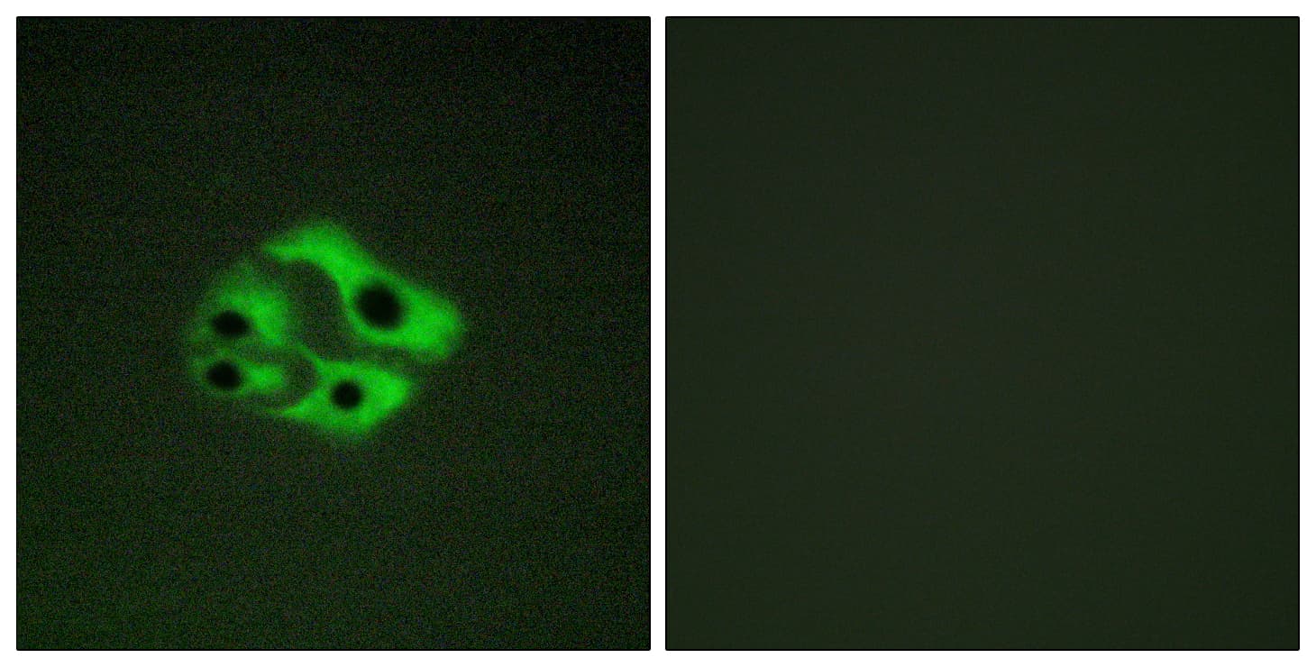 Polyclonal Rabbit anti-Human BAD Antibody (phospho-Ser134, IHC, IF, WB)