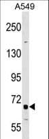 IHC-plus™ Polyclonal Rabbit anti-Human TNFRSF21 / DR6 Antibody (aa356-385, IHC, WB)