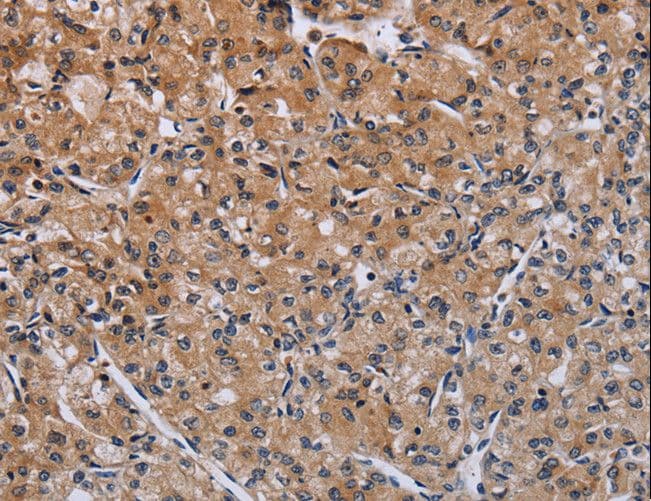 ACP6 Antibody