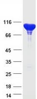 Human ACTN4 Protein (Recombinant Myc-DDK (Flag))