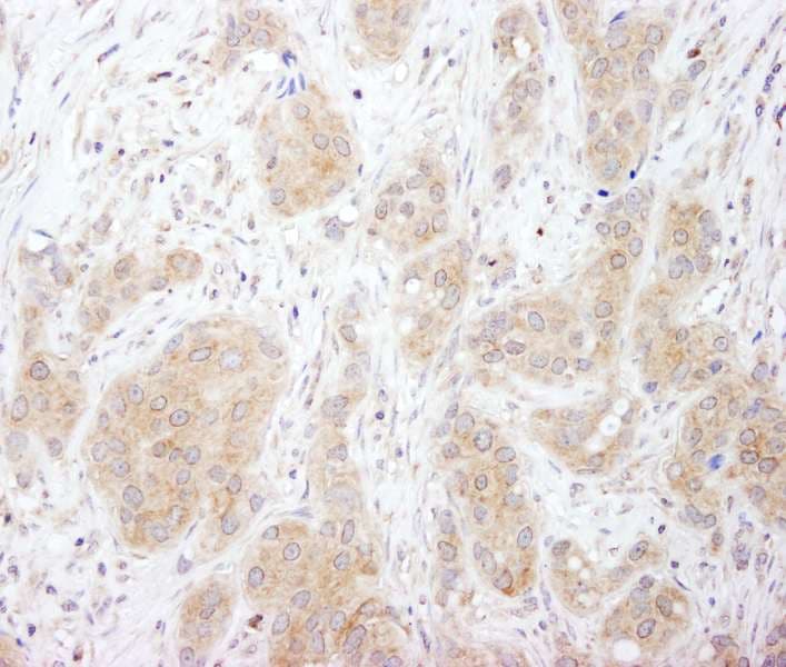 Polyclonal Rabbit anti-Human SNX1 Antibody (aa475-C-term, IHC, WB)