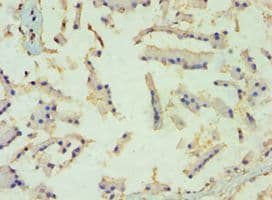 Polyclonal Rabbit anti-Human TBL1XR1 / TBLR1 Antibody (aa1-180, IHC, WB)