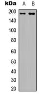 IRS1 Antibody (phospho-Ser794)