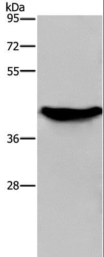 Polyclonal Rabbit anti-Human GALK1 / GK1 Antibody (IHC, WB)