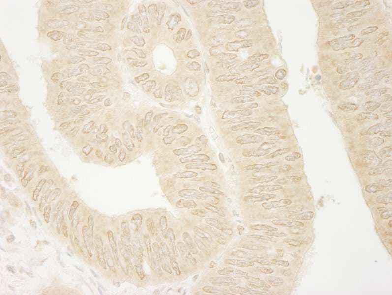 ARHGEF16 Antibody (aa175-225)