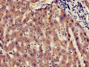 MMS2 / UBE2V2 Antibody