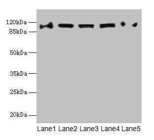 COPB1 / Beta-COP Antibody
