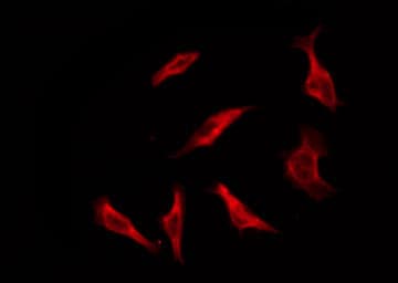 OR1S1+2 Antibody