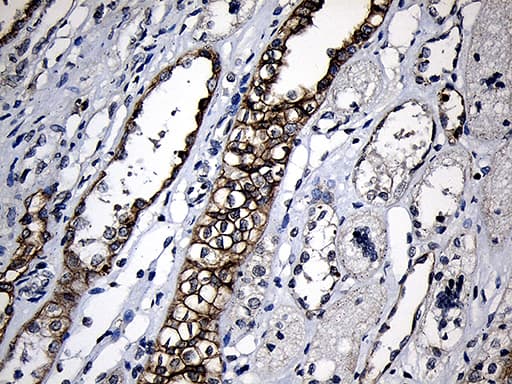 CPT1B Antibody (aa187-440, clone OTI2A6)