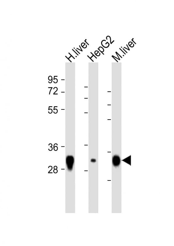 Rhodanese / TST Antibody (aa208-232)