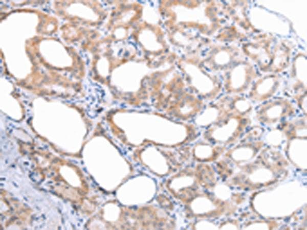 ATG16L1 / ATG16L Antibody