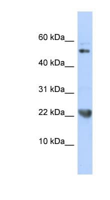Polyclonal Rabbit anti-Human TNFSF12 / TWEAK Antibody (aa35-84, WB)