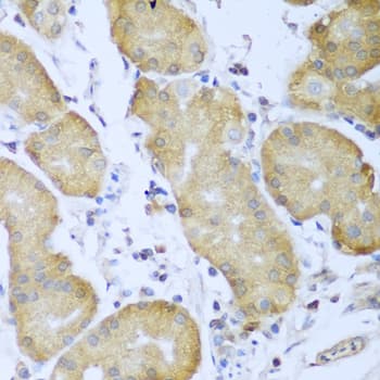 Polyclonal Rabbit anti-Human IMP-3 / IGF2BP3 Antibody (IHC, WB)