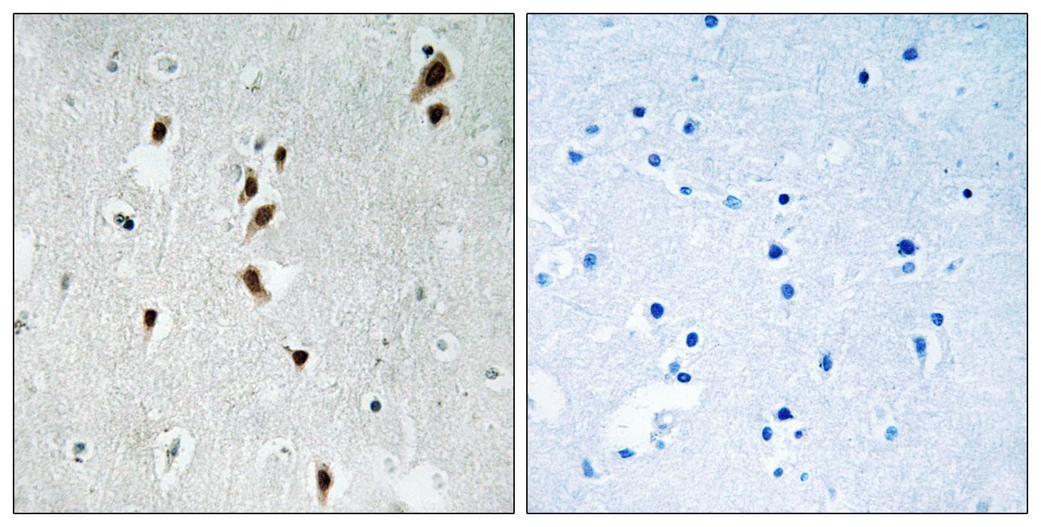 MKNK1 / MNK1 Antibody (phospho-Thr385)