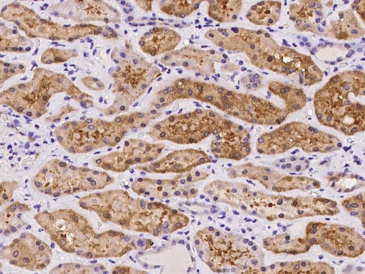 ASPA Antibody