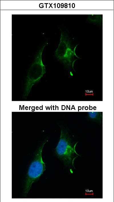 Polyclonal Rabbit anti-Human NPRA / NPR1 Antibody (IHC, IF, WB)