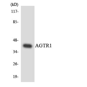 AGTR1 / AT1 Receptor Antibody (aa94-143)