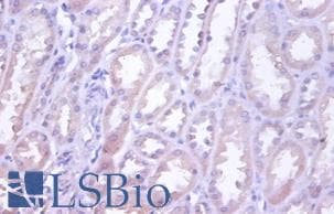 TRAIL-R4 / DCR2 Antibody