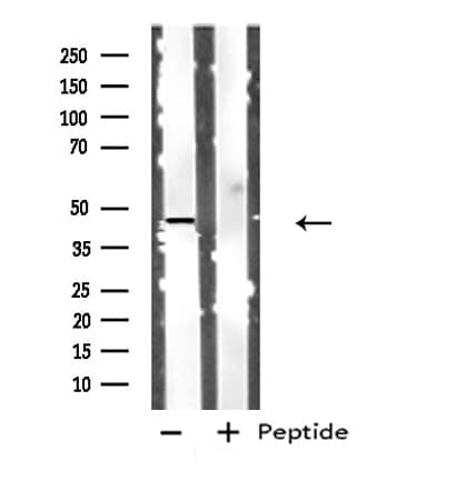CTSD / Cathepsin D Antibody