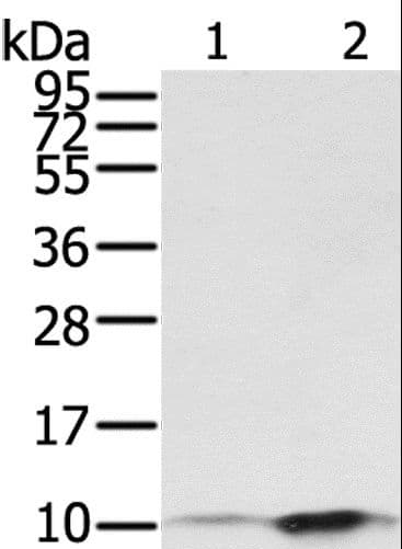S100P Antibody