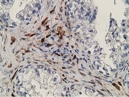 RBP1 / CRBP Antibody (clone OTI2H3)