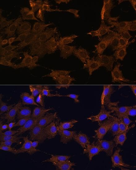 PDGFRB / PDGFR Beta Antibody