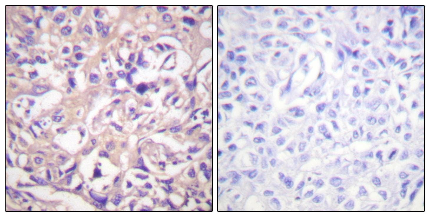 TK1 / TK / Thymidine Kinase Antibody (p13)