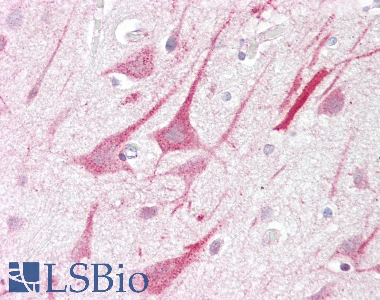 IHC-plus™ ZMYM2 / RAMP Antibody